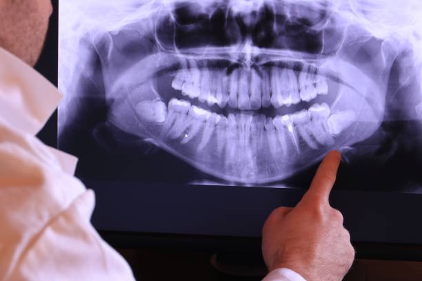 Best Emergency Treatment for Dental Infections or Abscesses in Rowland, NC